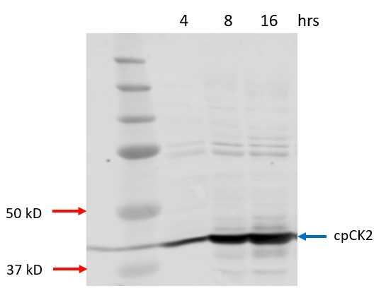 Western blot using anti-cpCK2 antibodies